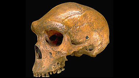 Người tiền sử có trình độ phẫu thuật tinh vi?