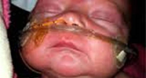 Bệnh ho gà liệu có quay trở lại?