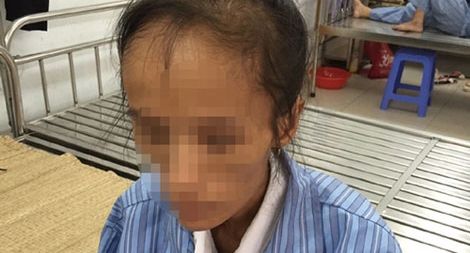 Trầm cảm sau sinh, nhiều sản phụ tự sát