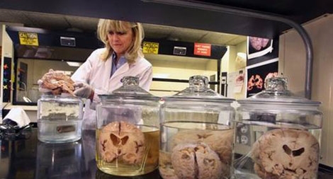 Hệ thống ngân hàng não bộ phục vụ nghiên cứu khoa học