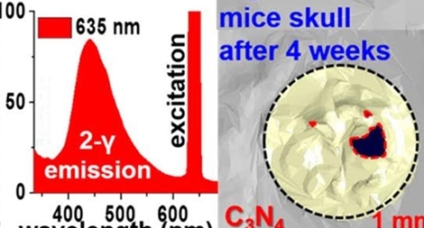 Kỹ thuật tái tạo xương từ tế bào tủy và vật liệu cacbon