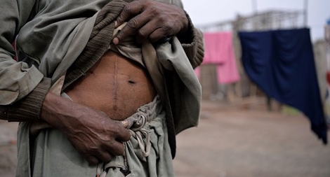 Pakistan: Đem số phận đặt cược vào… quả thận