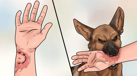 57 người tử vong vì bệnh dại trong 9 tháng đầu năm