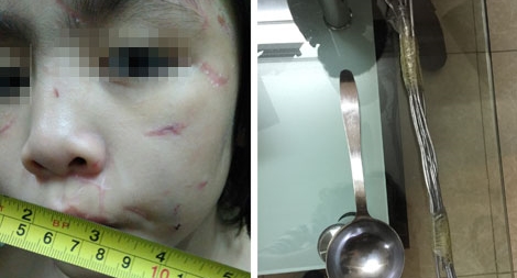 Đau lòng chuyện "bánh đúc có xương"