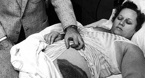 Người phụ nữ bị thiên thạch rơi trúng người