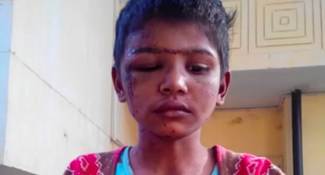 Nạn bạo hành trẻ giúp việc nhà ở Pakistan