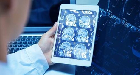 Ký ức con người có thể bị đánh cắp