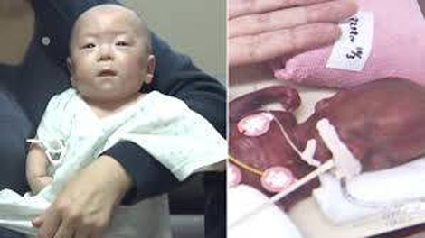 Bé trai sơ sinh nhỏ nhất thế giới
