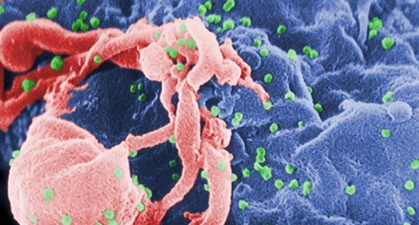 Sắp có chủng ngừa virus HIV?