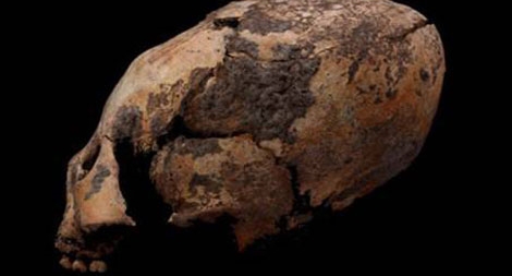 Bí ẩn xung quanh những chiếc xương sọ dài