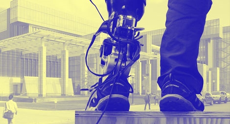 Chân giả "thông minh" cho người khuyết tật