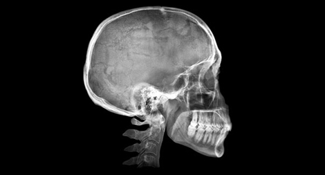 Lối sống hiện đại đã biến đổi bộ xương người thế nào?