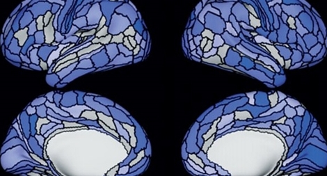 Nghiên cứu mới về cấu trúc não bất thường của tội phạm