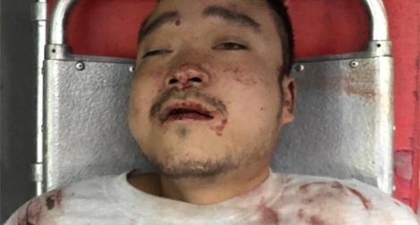 Tìm tung tích nạn nhân mặc áo có chữ HALONG VIETNAM