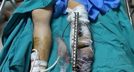 Điều tra vụ xông vào nhà chém người trọng thương