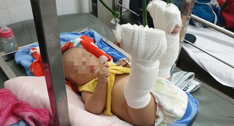 Để không còn nạn bạo hành trẻ em