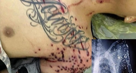 Khởi tố bị can vụ nổ súng gần trạm BOT khiến một người bị thương