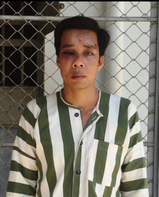 Lên mạng Zalo dụ người đồng tính chuốc thuốc mê cướp tài sản