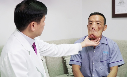 Trả lại cuộc sống bình thường cho người đàn ông… “mặt ma”