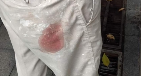 Thợ sơn bị trúng đạn khi sơn tháp chuông nhà thờ