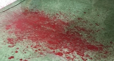 Cháu họ mượn tiền xã hội đen, nhà cô bị tạt sơn