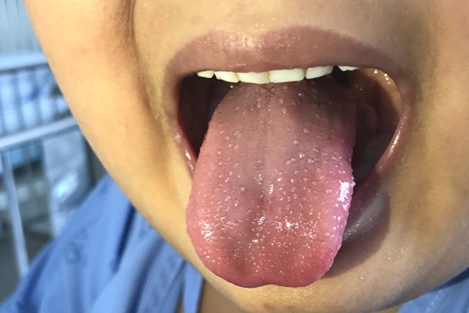 Điều cần biết về căn bệnh chết người ở trẻ em liên quan đến COVID-19