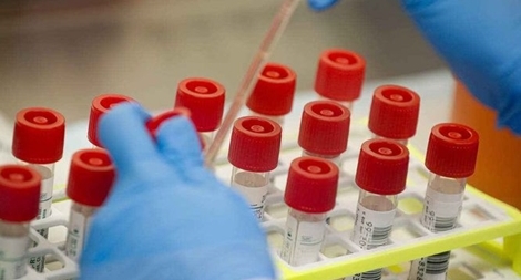 Bộ tự xét nghiệm COVID-19 đầu tiên được cấp phép trên thế giới 