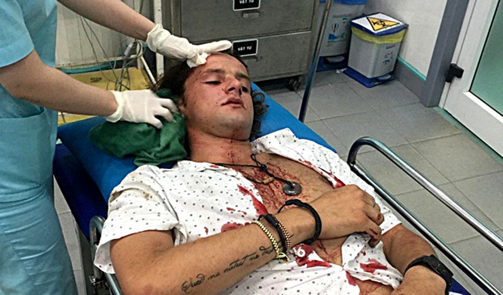 Xác định đối tượng đánh du khách người Australia bị thương tại Hội An