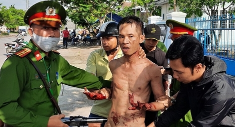 Khống chế kẻ nghi ngáo đá dùng dao tự thương