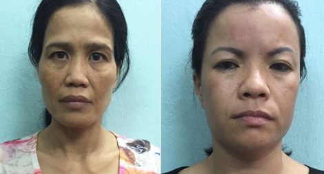 2 nữ quái tổ chức “đập đá” tại khách sạn