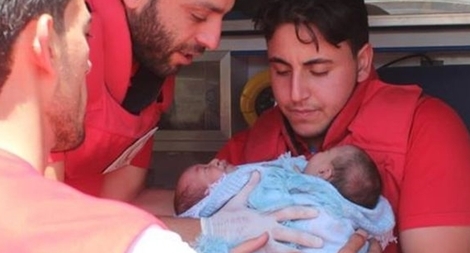 Nhói lòng cặp song sinh dính liền ra đời giữa bom rơi đạn nổ ở Syria
