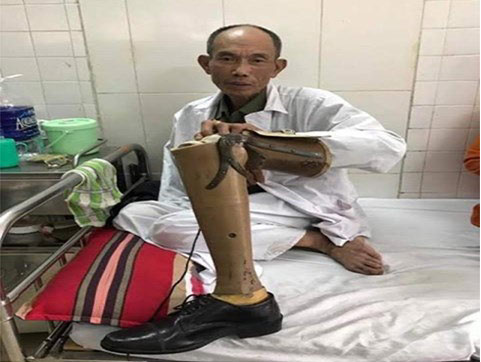 Khởi tố hình sự vụ đánh thương binh sau va chạm giao thông