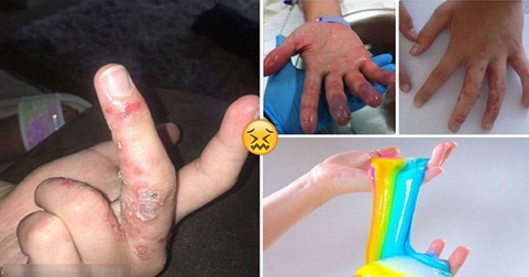 Cảnh giác với "chất nhờn ma quái"