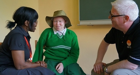 Làn sóng tấn công người mắc chứng bạch tạng ở Tanzania