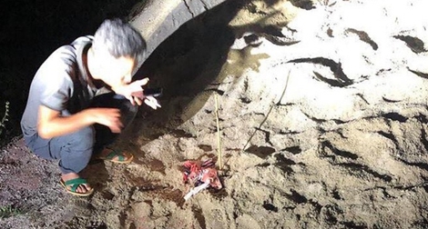 Bé trai 7 tuổi bị đàn chó cắn nhập viện trong tình trạng nguy kịch