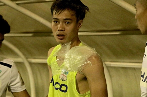 Hoàng Anh Gia Lai đón cơn bão chấn thương sau chiến thắng