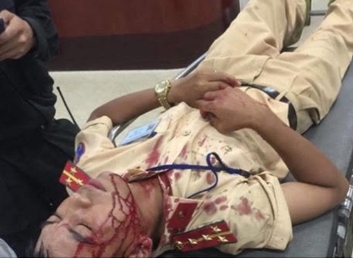 Đại uý CSGT bị người vi phạm dùng gạch tấn công nhập viện