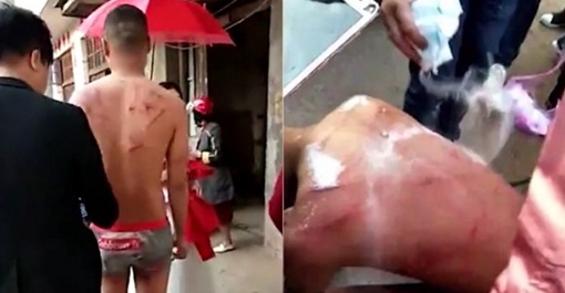 Hãi hùng tập tục chú rể bị lột quần áo đánh và sát muối lên vết thương