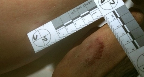 Ngồi tù oan 23 năm vì bằng chứng giám định thiếu chính xác