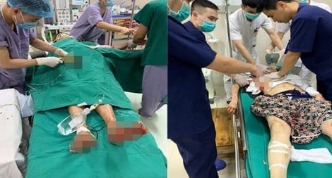 Ghen tuông chồng truy sát cả nhà vợ rồi treo cổ tự tử