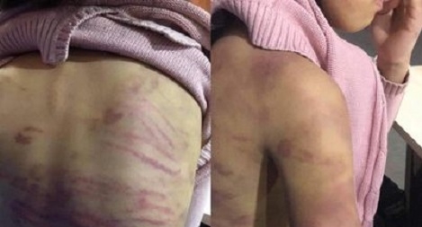 Mẹ và người tình bạo hành con gái 15 tuổi