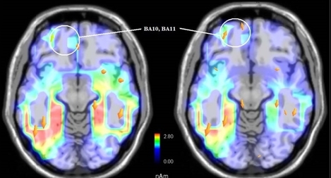Não người cũng biết tiên tri?