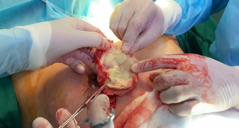 Cơ sở thẩm mỹ “chui” ngang nhiên hoạt động