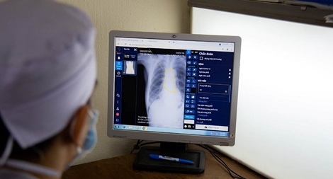 Bảo vệ "thành trì" chống dịch COVID-19 bằng đẩy mạnh ứng dụng AI trong y tế