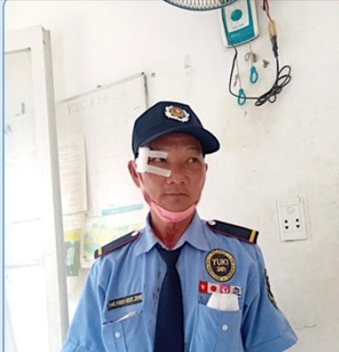 Khởi tố đối tượng đánh bảo vệ khi bị nhắc nhở đeo khẩu trang