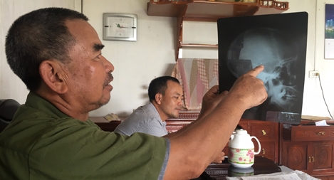 Bị thương gần nửa thế kỷ chưa được hưởng chế độ thương binh