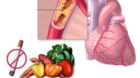 Phòng chống bệnh tim mạch từ thực phẩm