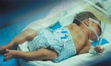 Hãi hùng những đứa trẻ bị đầu độc bởi người thân hút thuốc