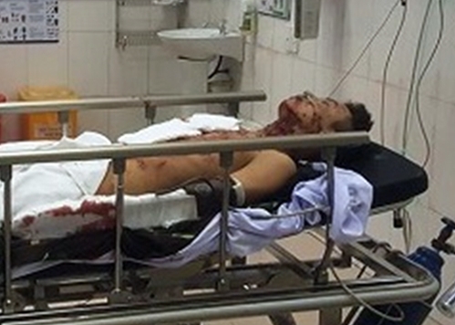 Nổ bình gas mini, nam thanh niên tử vong trong lúc nấu ăn