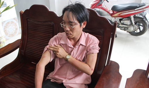 Dùng roi điện tấn công chủ tiệm vàng, cướp đoạt hơn 2 tỷ đồng